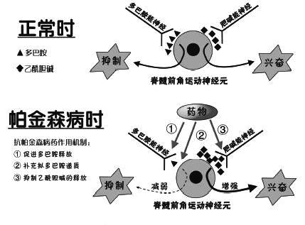 择思达斯家用经颅磁_帕金森为什么会越来越严重