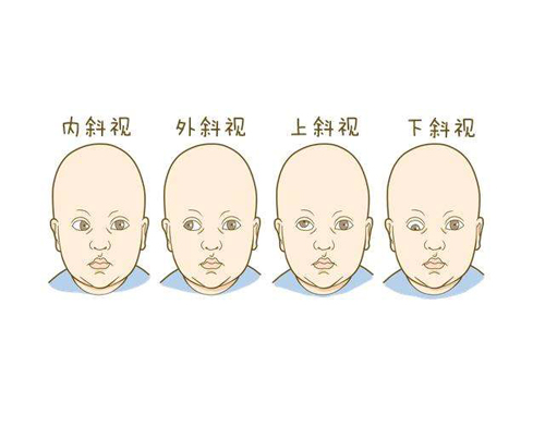 什么人需要经颅磁治疗_脑瘫会有什么误区呢